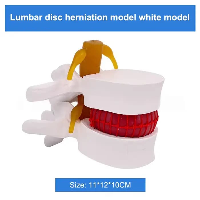 Modèle lombaire professionnel, squelette d'anatomie humaine, colonne vertébrale, hernie discale lomb