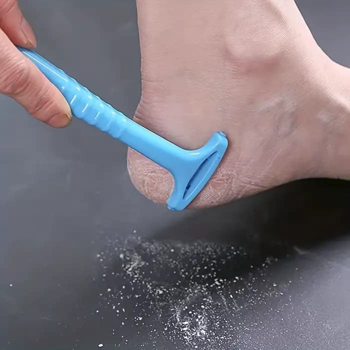 Dissolvant de callosités du talon du pied