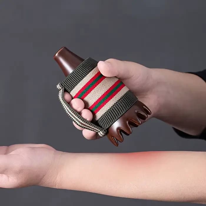 Brûleur de Moxibustion à 12 Dents pour Dragage des d'œuvre diens