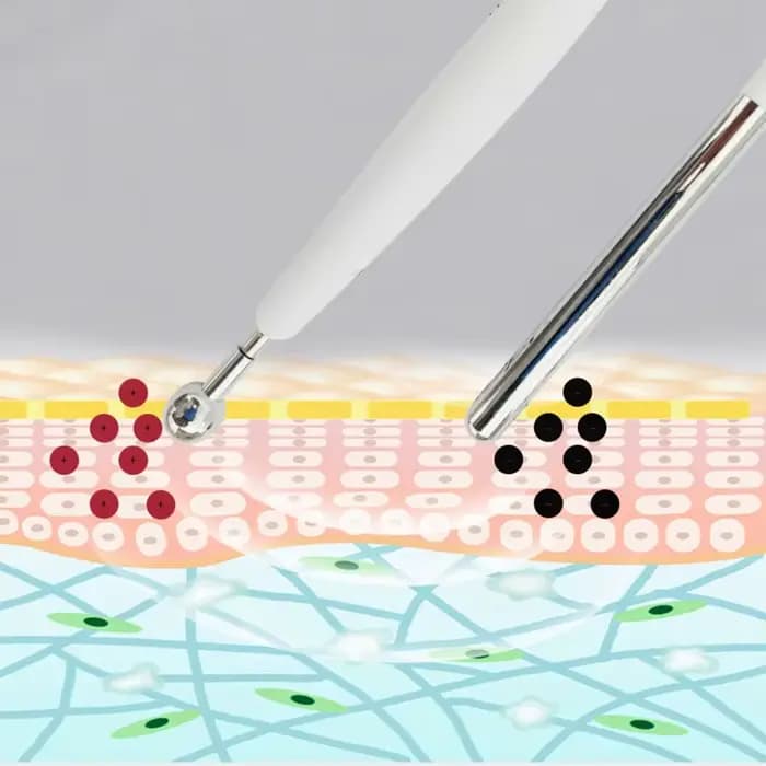 Machine à merlan à micro-courant galvanique