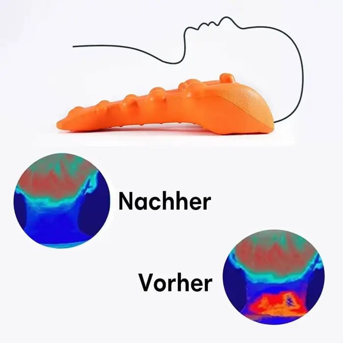 Appareil de Traction cervicale