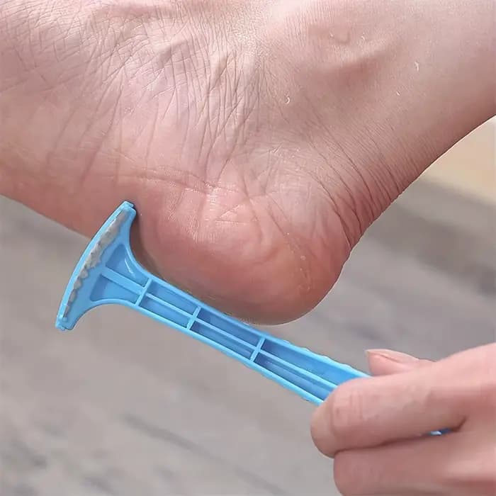 Dissolvant de callosités du talon du pied