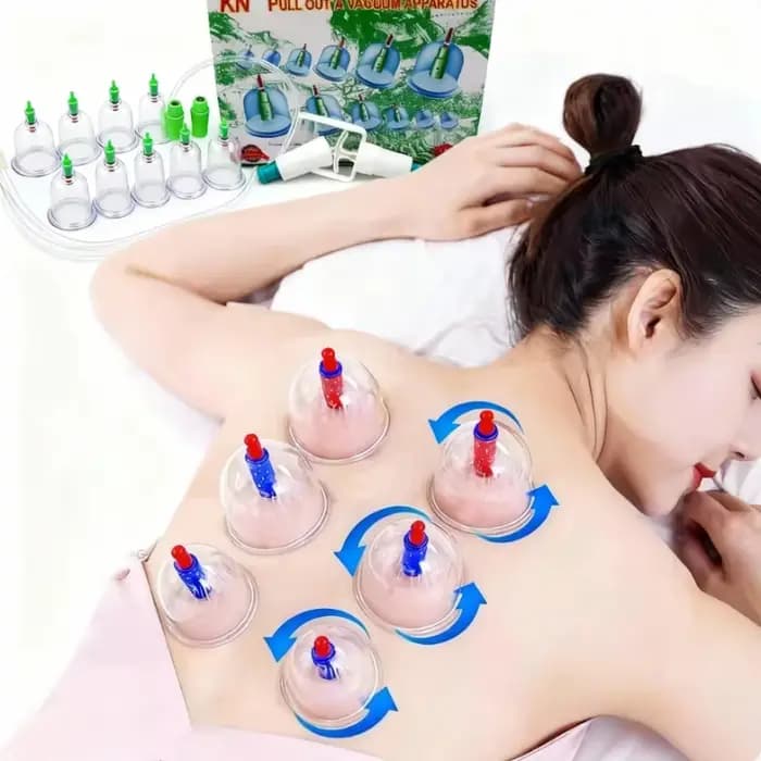 6/12/24 Pièces Ventouses de Massage et de Thérapie Chinoise