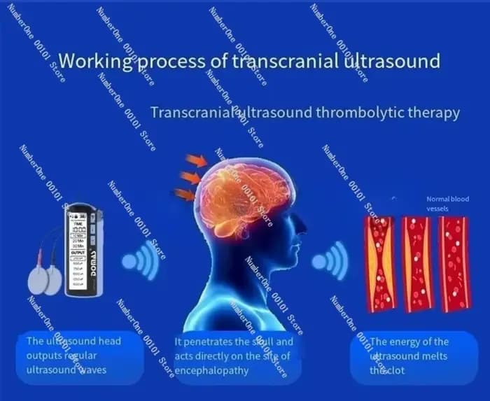 Électrique tDCS transcranique magnétique stimulation du cerveau maux de tête soulagement de la douleur thérapie