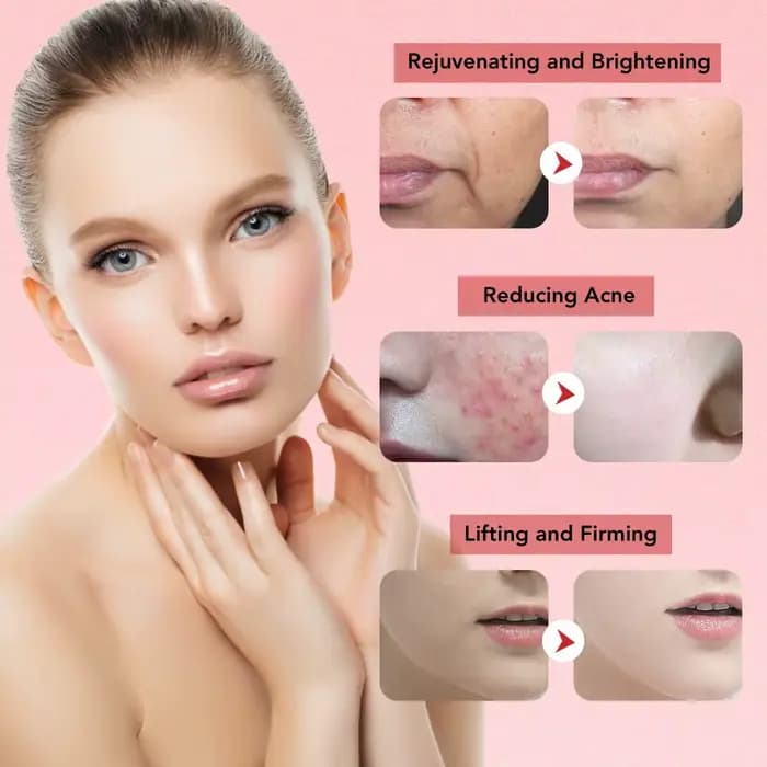 Appareil de Lifting du visage multifonction 7 en 1