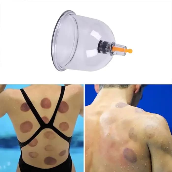 Pot de Massage à ventouses sous vide