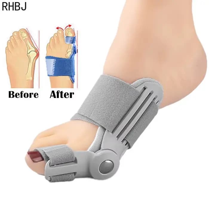 RHBJ 2 pièces dispositif orthopédique correcteur d'oignon Hallux Valgus Correction des orteils pédicure outil de soin des pieds pouce gros os orthèses