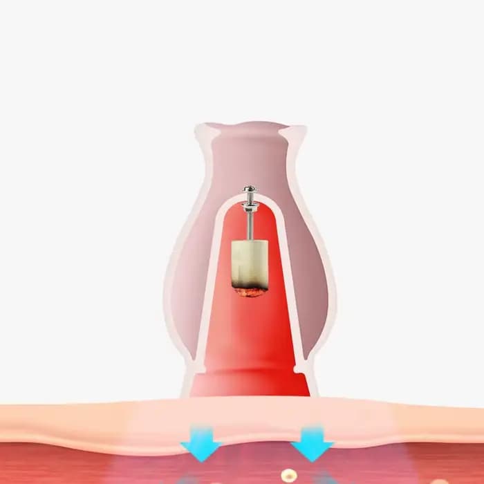 Pot de Moxibustion en Céramique pour Thérapie Faciale